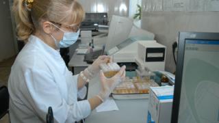 В Пятигорске 477 человек обследовались в мобильном диабет-центре