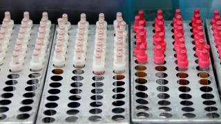 Более 3500 литров биоматериала заготовил мобильный комплекс переливания крови на Ставрополье