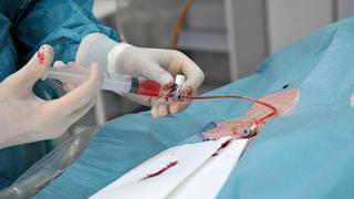Работники ставропольской больницы дважды получали деньги за одну и ту же операцию